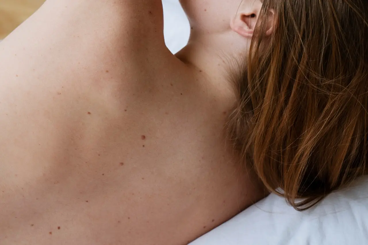 Come eliminare le verruche in modo naturale? L’antico rimedio che le fa cadere da sole